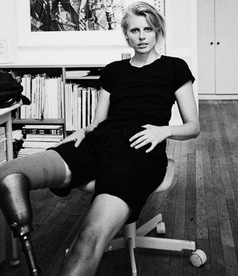 Lauren Wasser perdió una extremidad y ha mostrado su belleza real