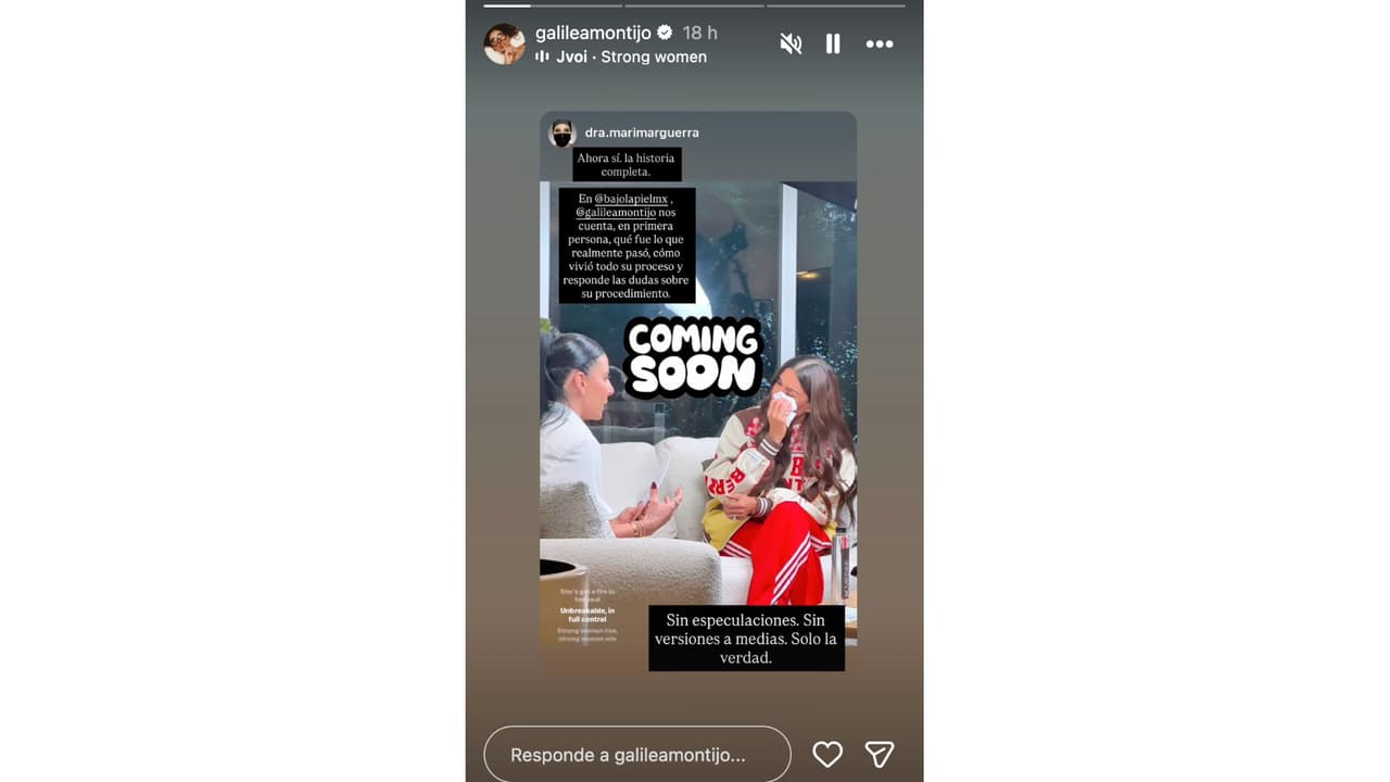 Galilea Montijo cuenta la verdad sobre lo que le pasó en el rostro.