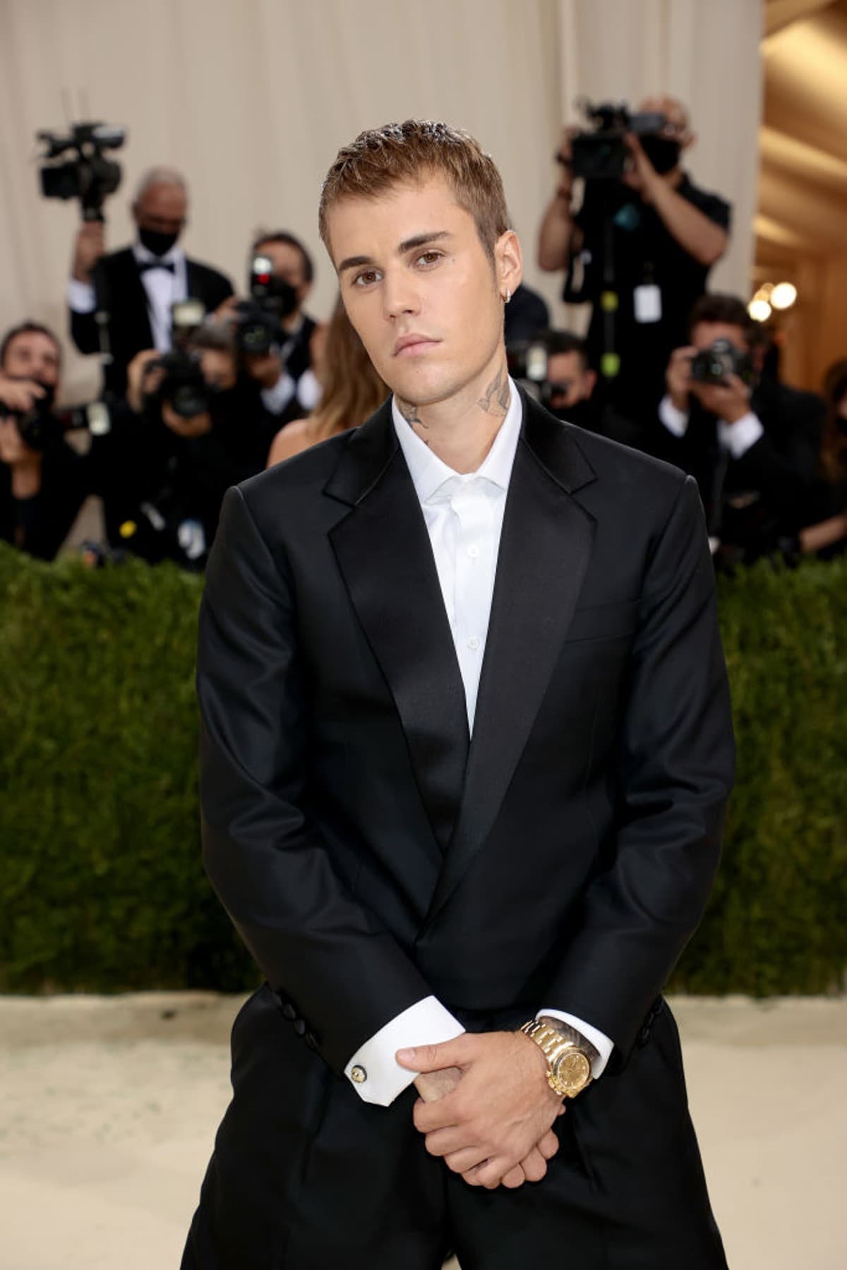 Justin Bieber: ¿qué es el síndrome de Ramsay Hunt que padece?