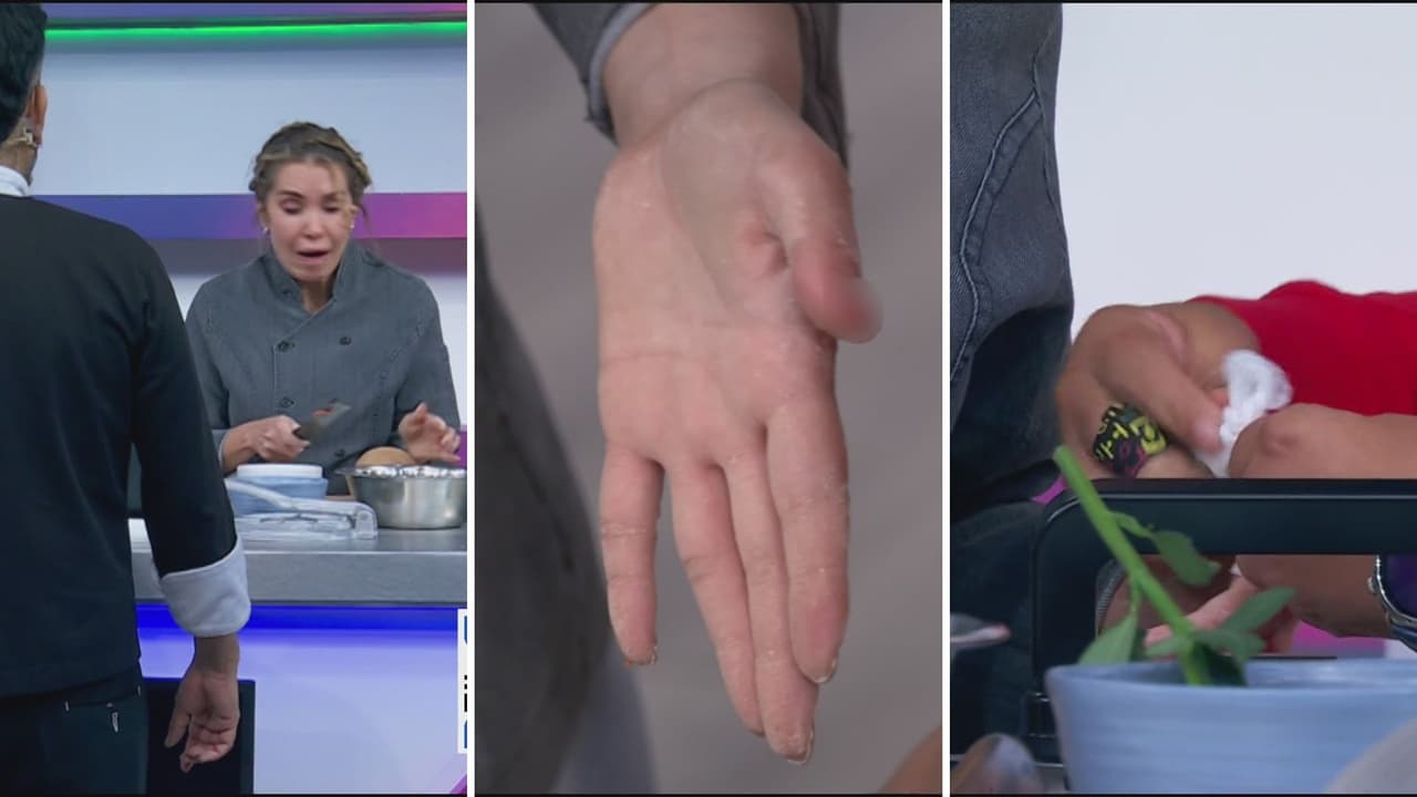 Andrea Escalona sufrió un accidente.