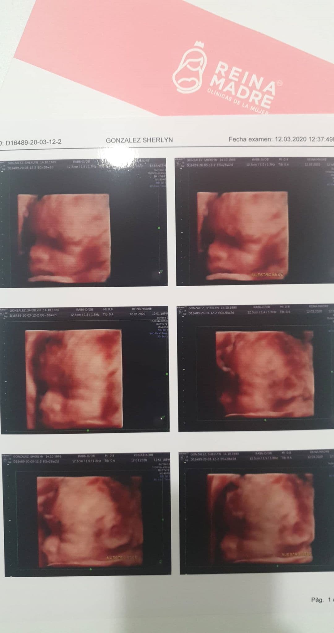 Sherlyn mostró el ultrasonido 4D que se realizó a sus siete meses de embarazo