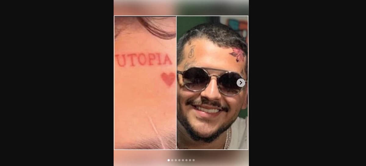 El cantante se borró el tatuaje que tenía de su exnovia en la frente