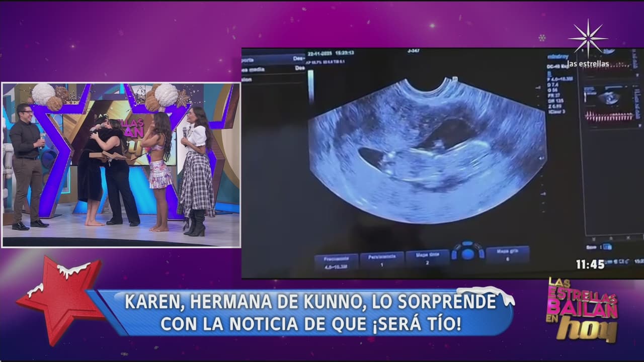 Integrante de Hoy anuncia embarazo en vivo y muestra la primera foto del bebé: “Es increíble este milagro”