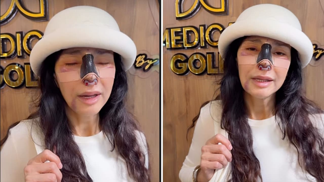 Dorismar reaparece en redes y comparte que se sometió a una cirugía recostructiva en la nariz