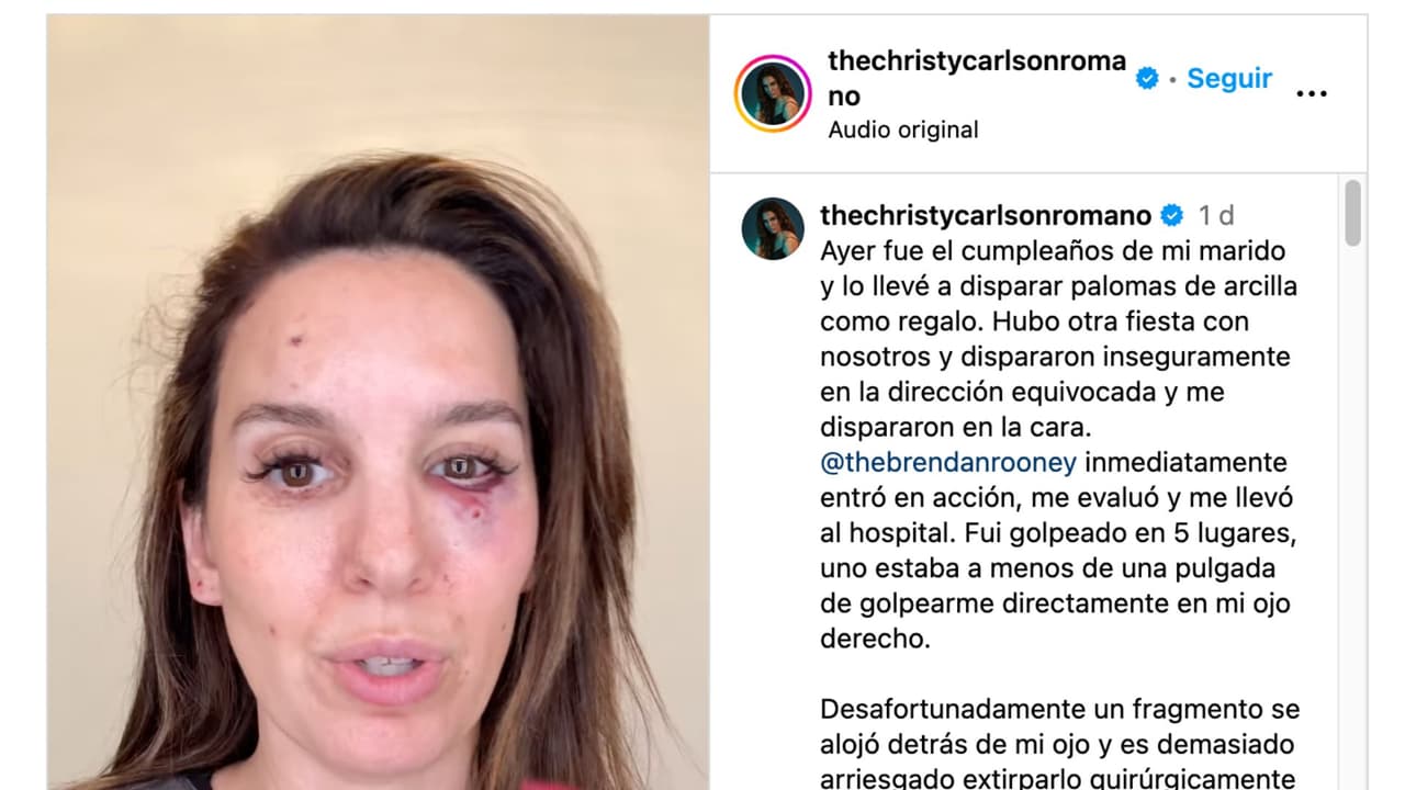 Christy Carlson Romano sufre aparatoso accidente: le disparan en el ojo.