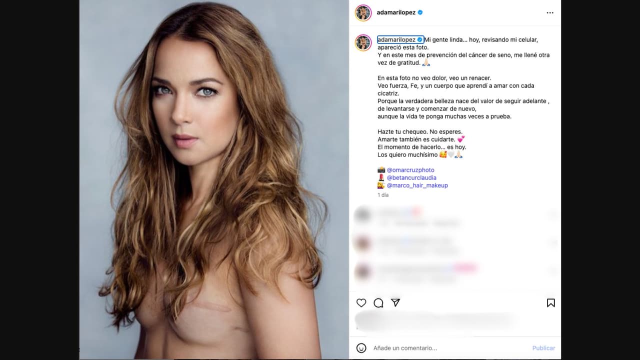Adamari López comporte foto de su cicatriz tras padecer cáncer de mama