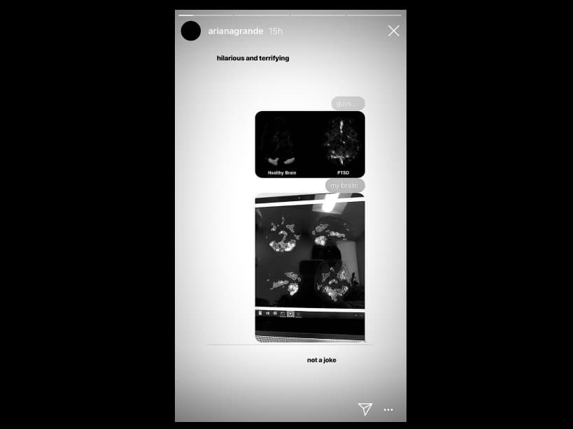 Así luce el cerebro de Ariana Grande