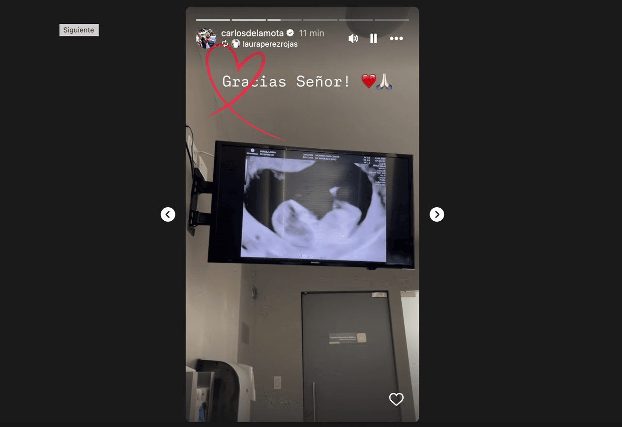 Actor de 'Lo que la vida me robó' muestra a su bebé arcoíris