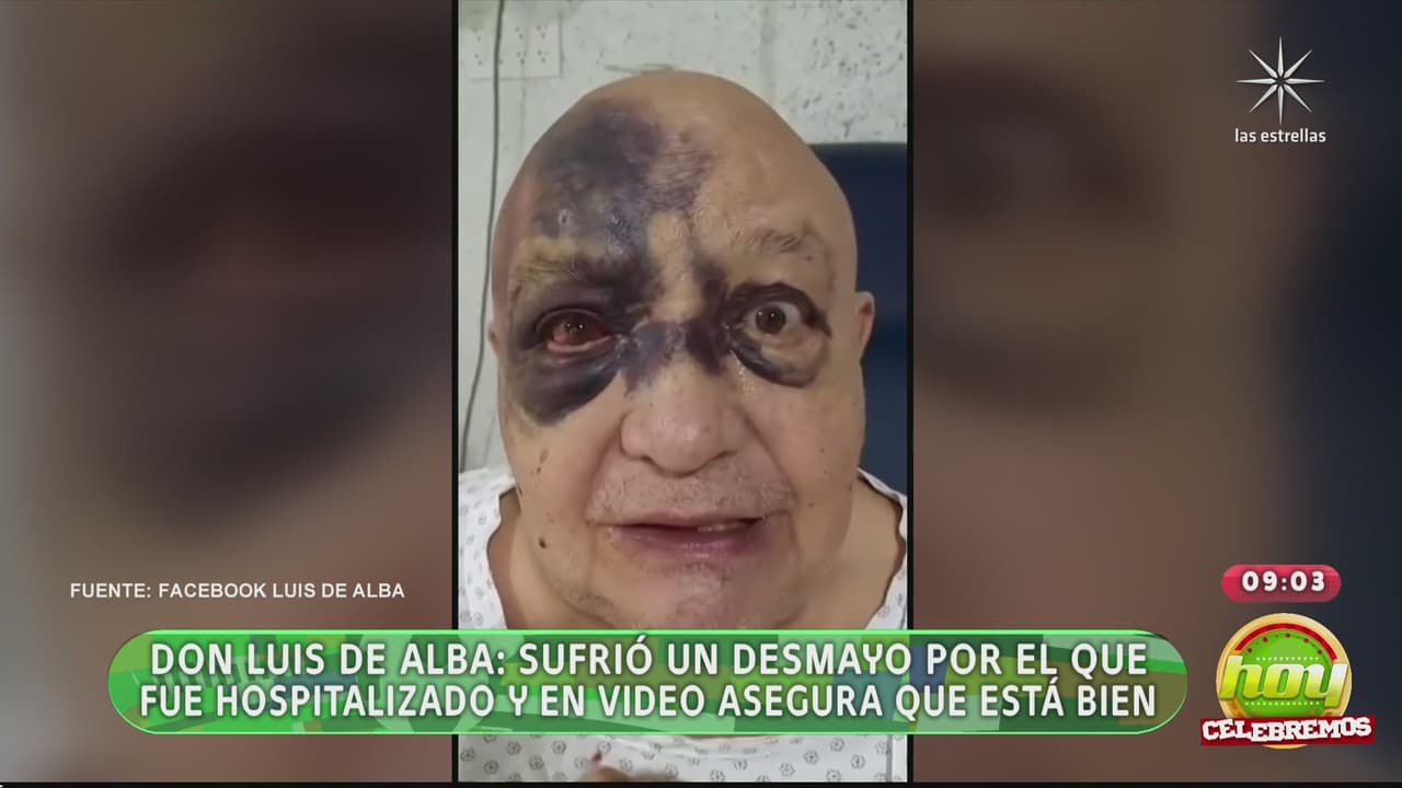 Reportan en Hoy hospitalización de actor de Televisa; con voz entrecortada, Andrea Legarreta reacciona en vivo: “Qué pena”