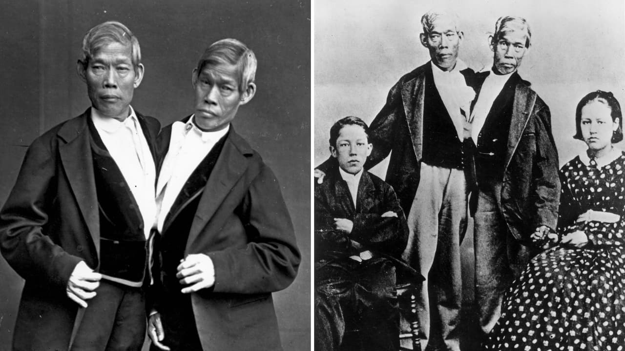 Los siameses más famosos de la historia: Chang y Eng Bunker se casaron y tuvieron 21 hijos
