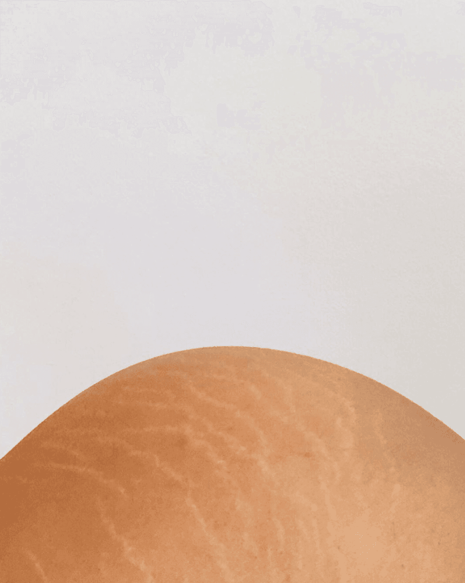 La actriz también ha publicado fotografías de sus estrías y ha dejado en claro que tenerlas es natural, así como el poseer estrías, arrugas y vello en el cuerpo. “Que el sistema intente convencernos de que no es así y nos esclavicemos persiguiendo ESTÁNDARES DE BELLEZA TÓXICOS, atentando contra la naturaleza de nuestros cuerpos, gastando nuestro dinero, tiempo y energía , y modificándonos al punto de llegar a rechazar lo que somos: NO ES NATURAL”.