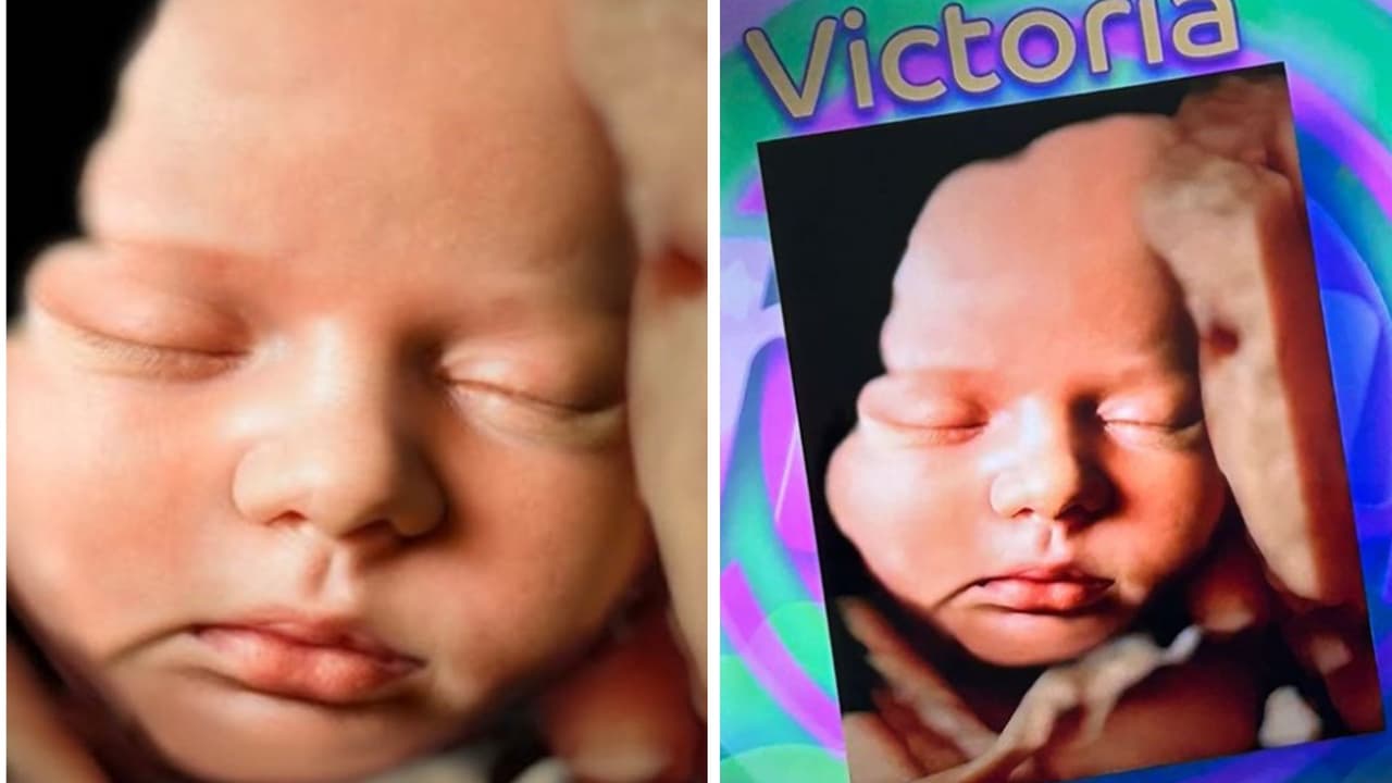 Joely Bernat presentó el ultrasonido en 6D y 8K de su hija Victoria en el programa 'Hoy'