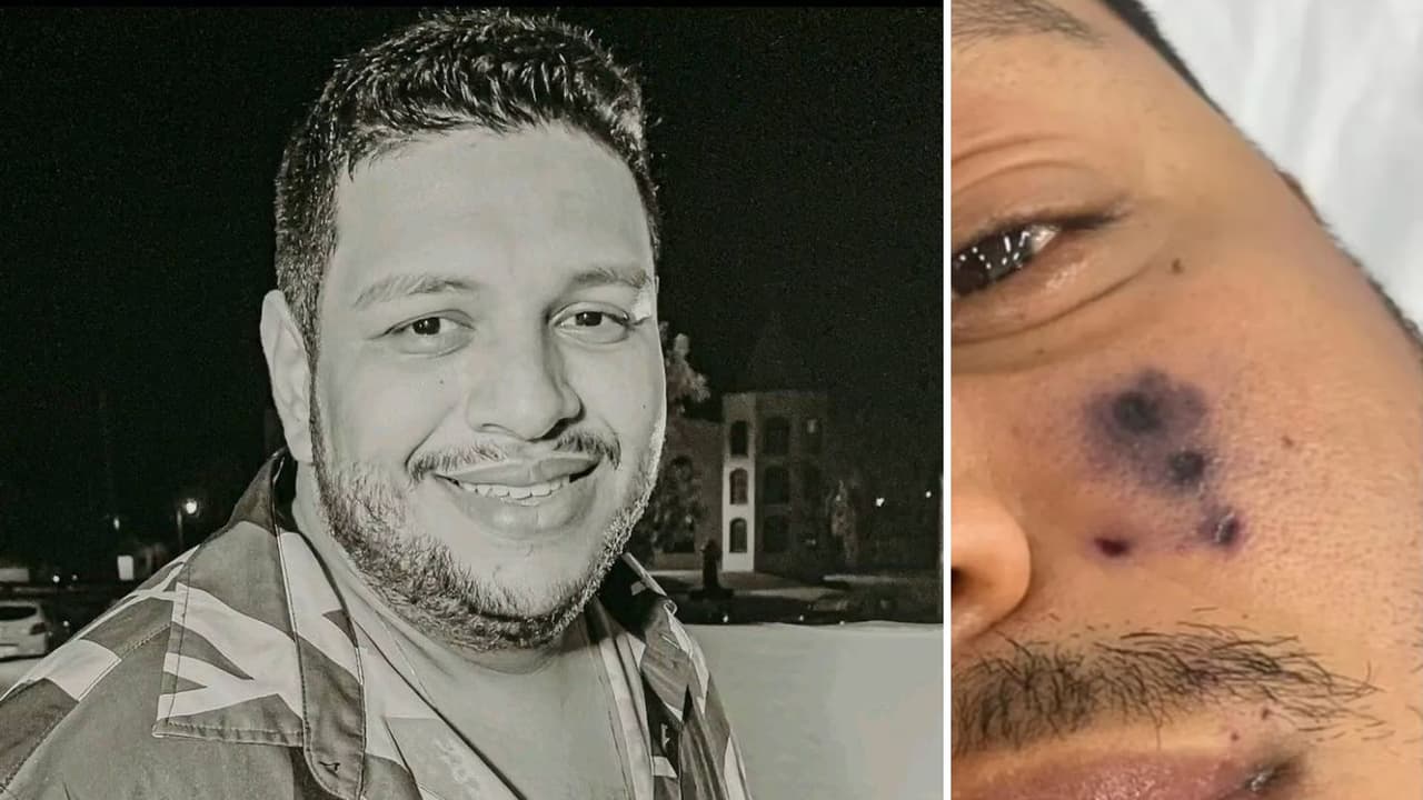 Esposa del cantante Darlyn Morais afirma que él sufrió la picadura de una araña.