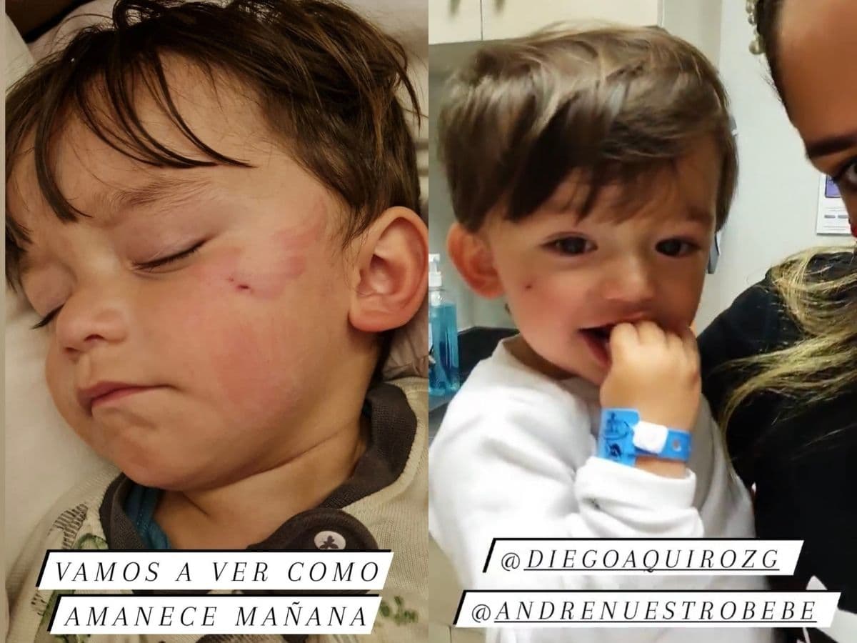 Sherlyn exhibe en foto percance que sufrió su hijo; su perrita mordió el rostro de André