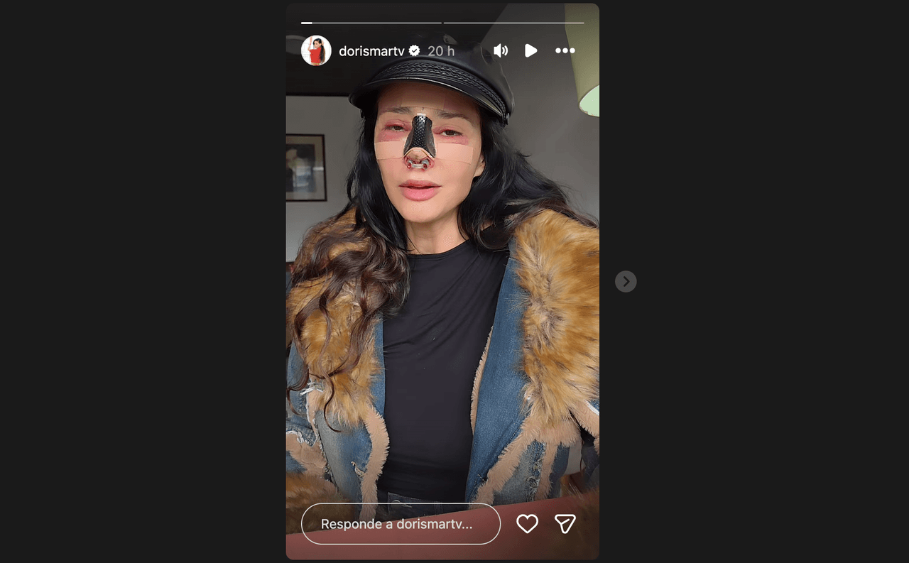 Actriz de ‘Como dice el dicho’ se deja ver desfigurada y mutilada; revela la fuerte decisión que tomó