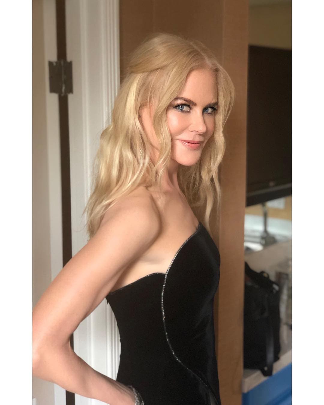 En una entrevista que concedió a la revista Marie Claire en 2007, Nicole Kidman confesó que padeció esta enfermedad. “Pese a todo tuve un principio de cáncer de piel en una de mis piernas porque las expuse al sol”, declaró.
