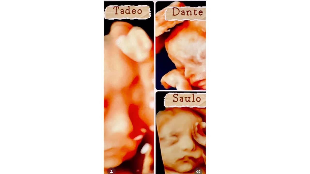 Cómo lucían los hijos de Ferdinando Valencia y Brenda Kellerman antes de nacer.