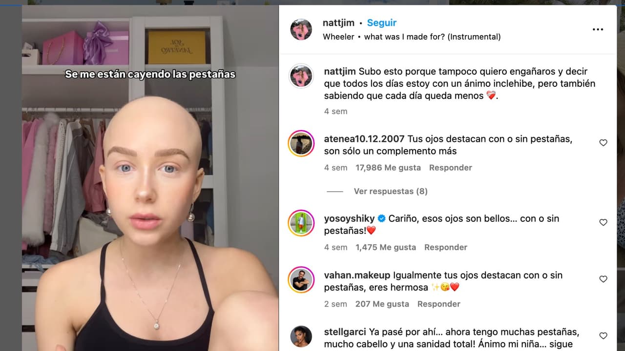 Natalia Jiménez lamenta pérdida de sus pestañas.