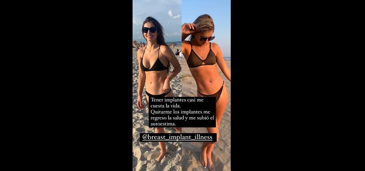 La actriz reveló que sus implantes de mama estuvieron a punto de matarla