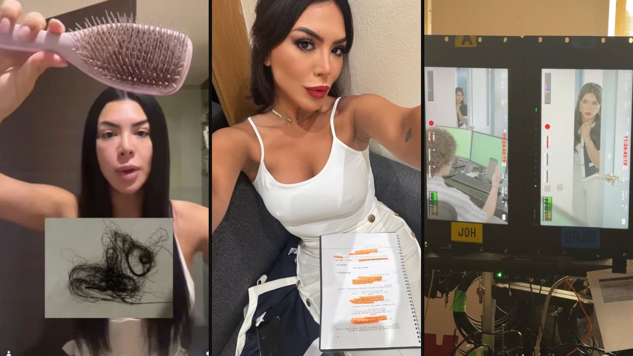 Paola Villalobos comparte su experiencia tras sufrir pérdida de cabello por alopecia