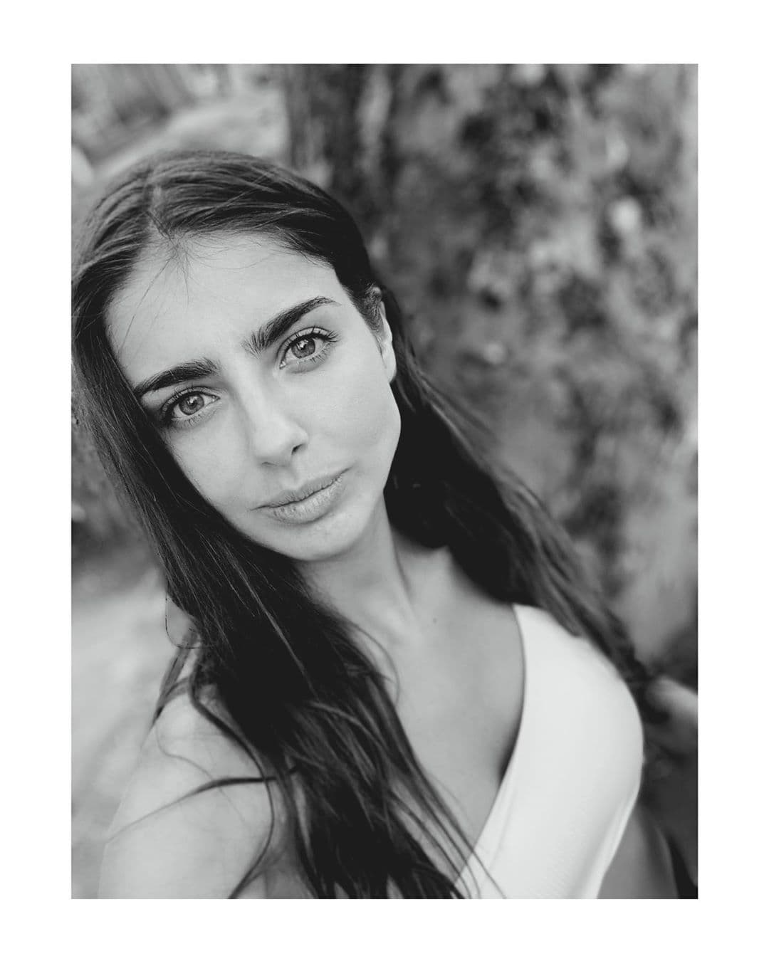 Michelle Renaud se sincera sobre la enfermedad que le provocaron sus implantes de busto