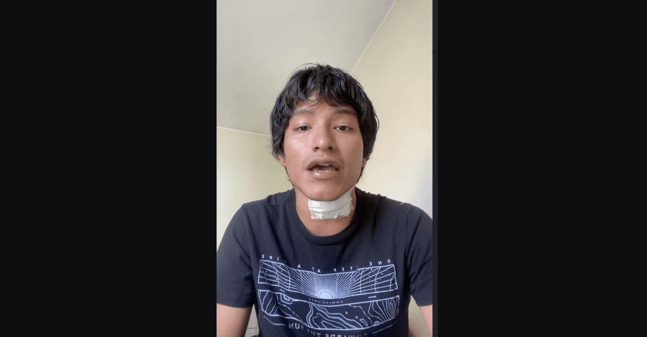 Famoso cantante se electrocuta en pleno concierto: publican video del brutal accidente y revelan las quemaduras que sufrió