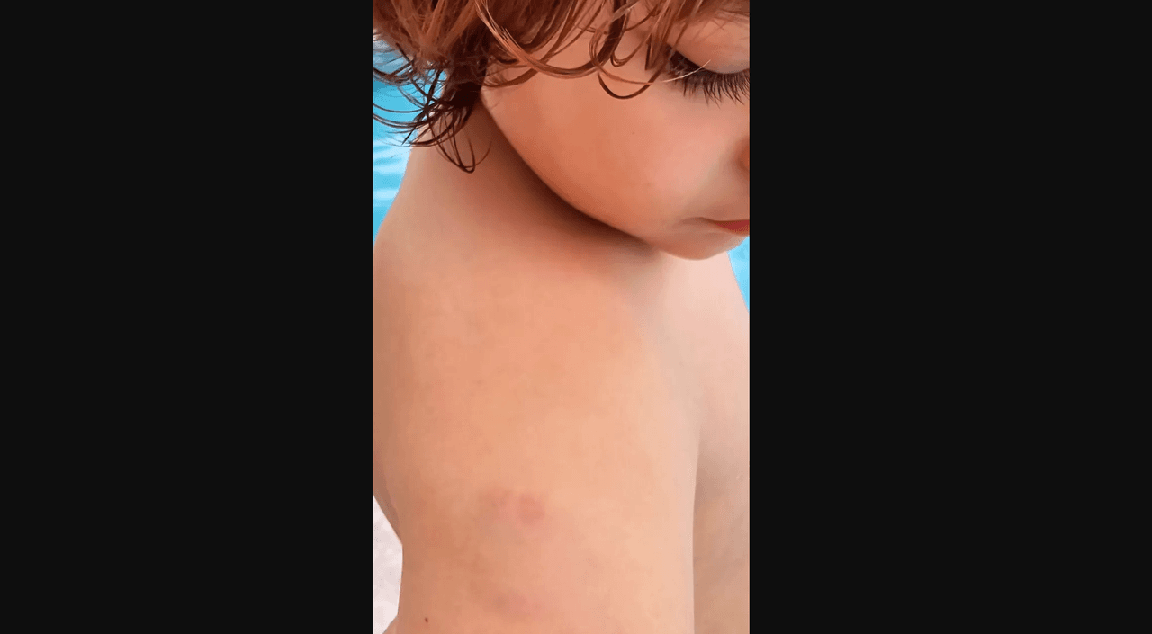 Sherlyn muestra el ataque que sufrió su hijo