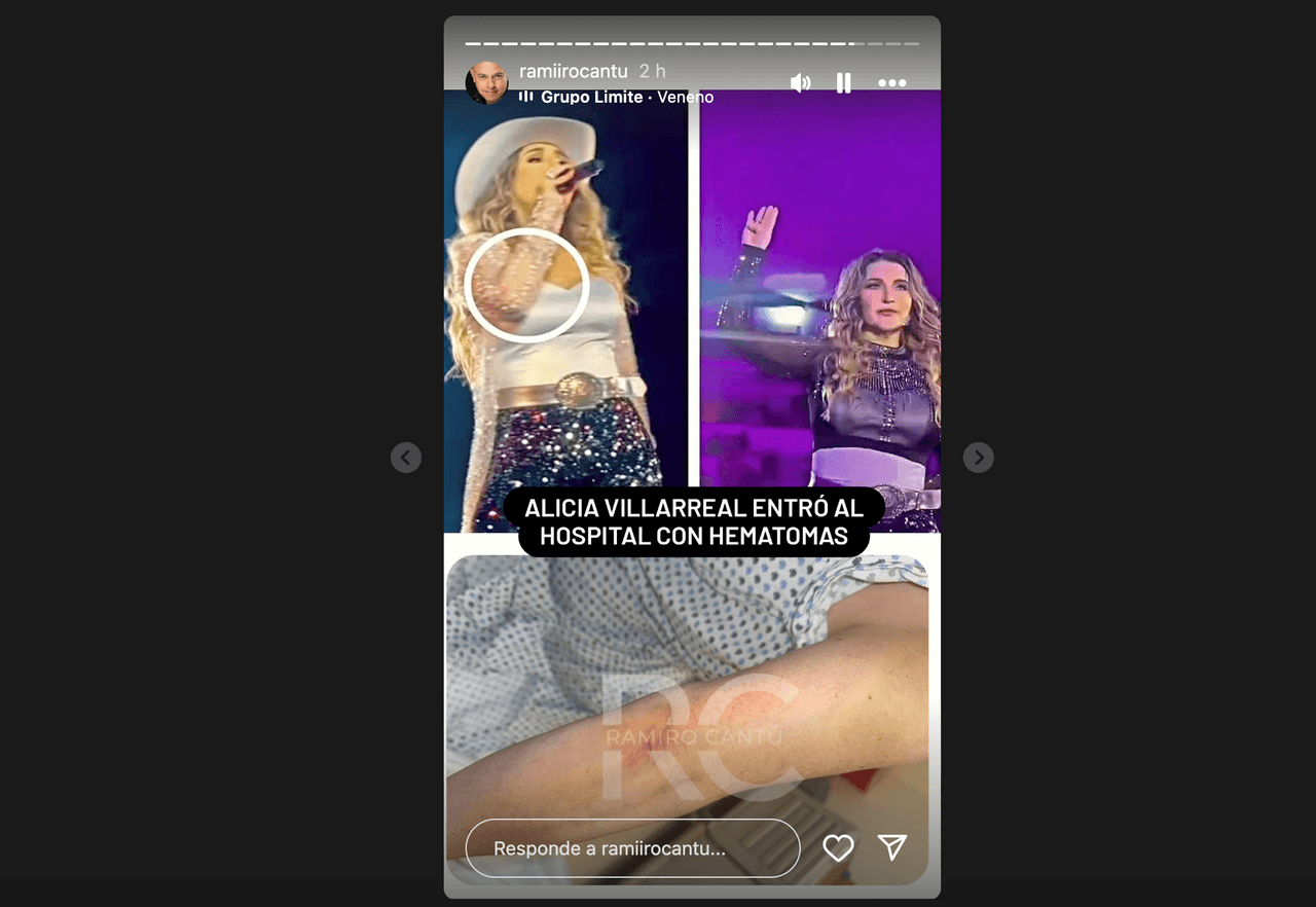 Así llegó Alicia Villarreal al hospital tras golpes de Cruz Martínez