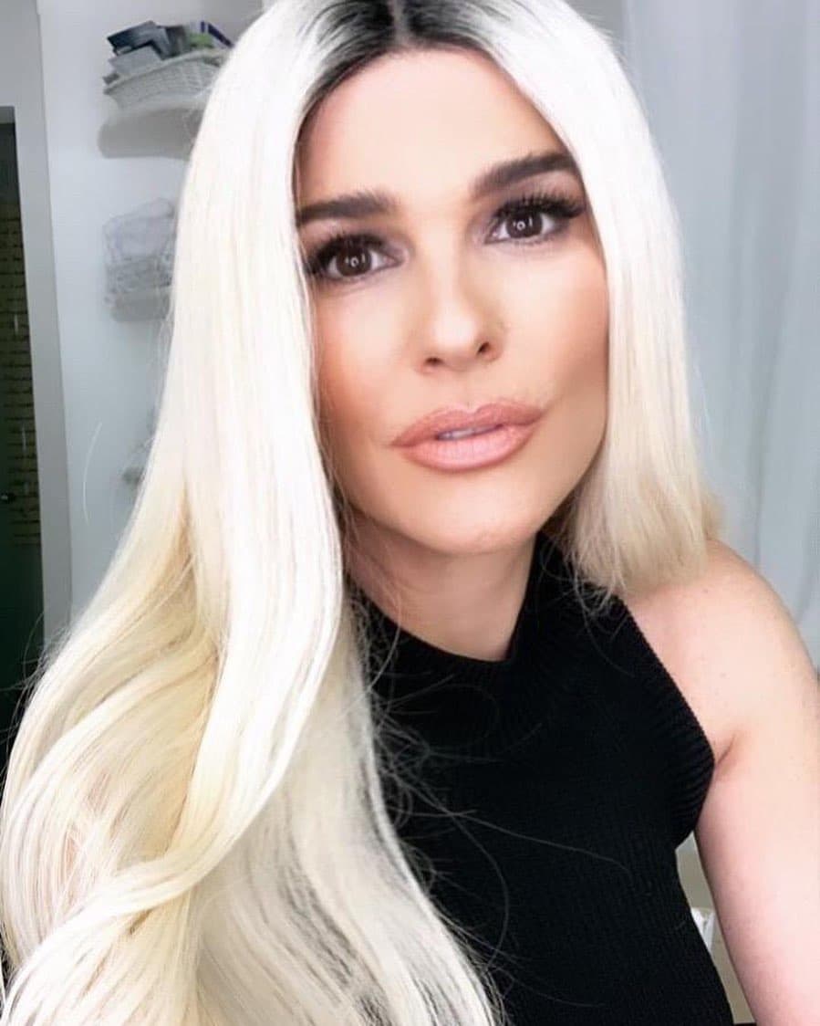 Dicha peluca es todo un lujo, pues cada pelo se pega uno por uno con pegamento, por lo que están hechas a mano con tul.