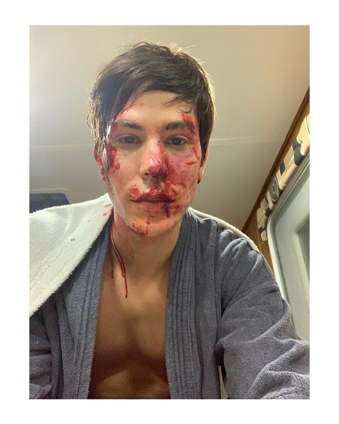 Christian Chávez impacta al publicar una foto con el rostro "ensangrentado"