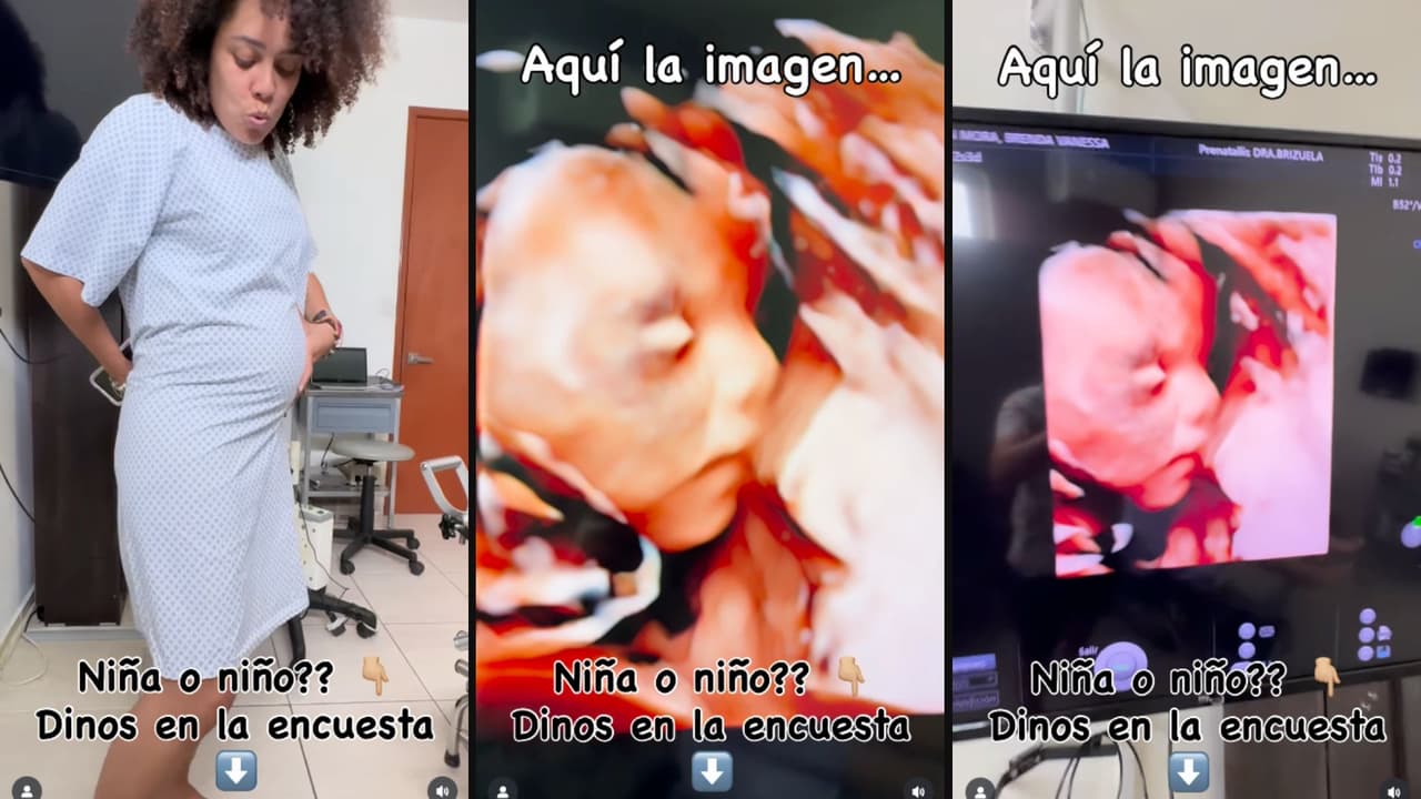 Ferdinando Valencia y Brenda Kellerman comparten el primer ultrasonido de su bebé arcoíris