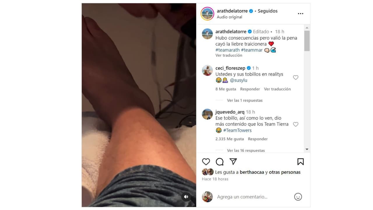 Arath muestra su tobillo lastimado.