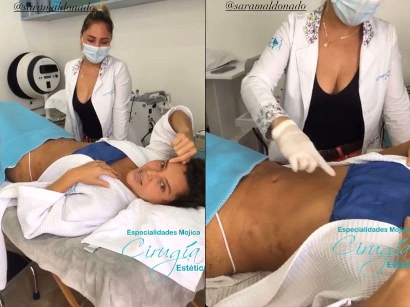 Sara Maldonado reapareció a nueve días de su cirugía estética.