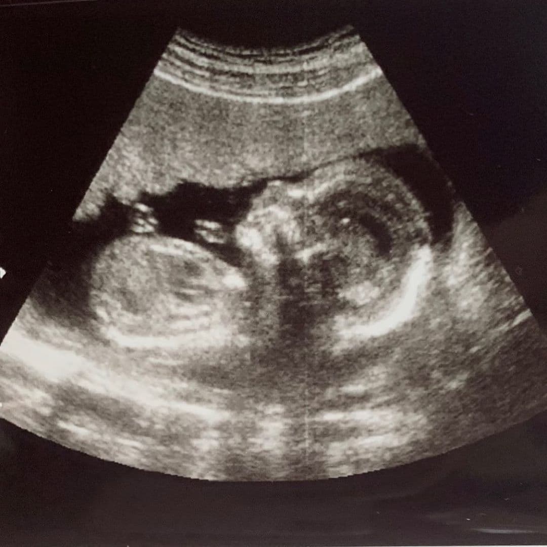 La actriz celebró el cumpleaños de su pareja, León Peraza, con una imagen del ultrasonido de su primer hijo.