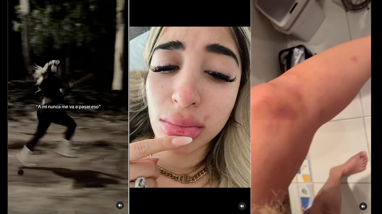 Influencer Queen Buenrostro muestra los golpes que, supuestamente, le dio Brandon Castañeda