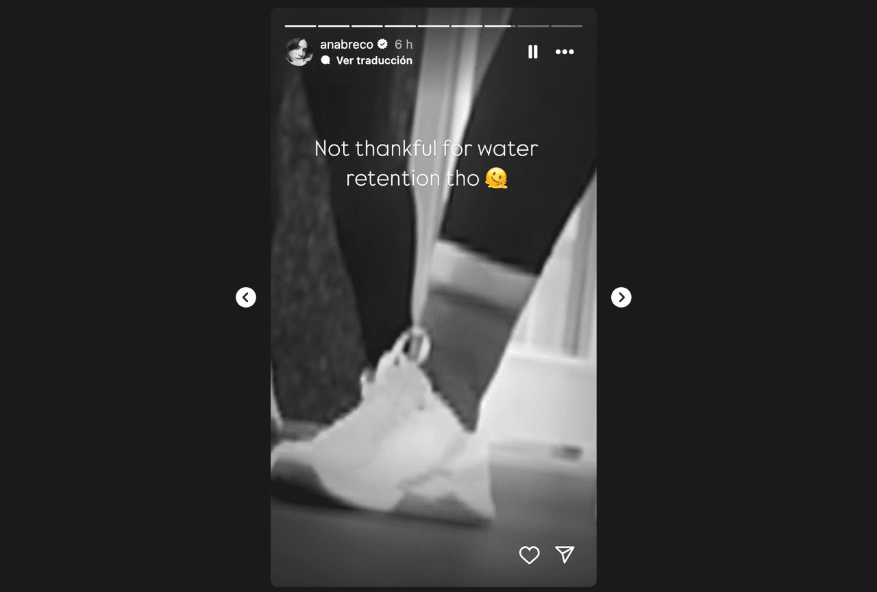 Ana Brenda mostró una de las complicaciones que sufre durante su embarazo