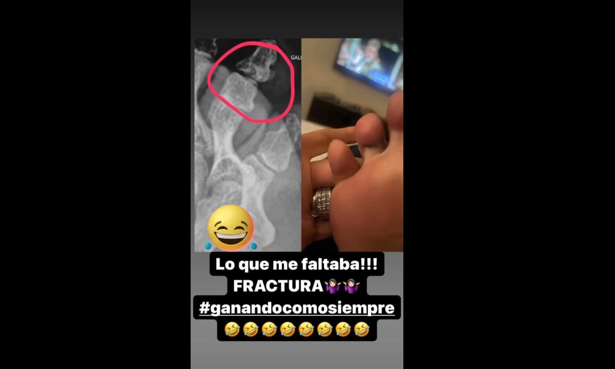 La conductora dejó ver en redes sociales cómo luce su pie