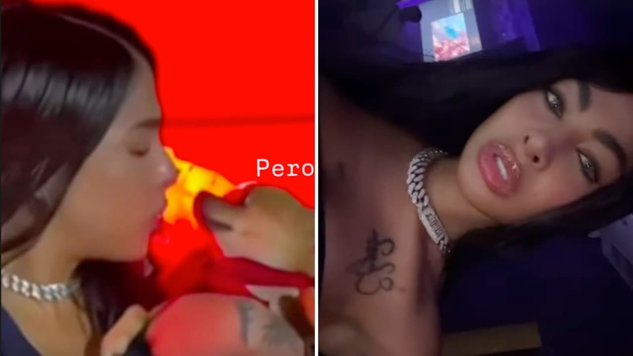 ¿Cómo quedó el rostro de Yailin tras ser mordida por un perro?