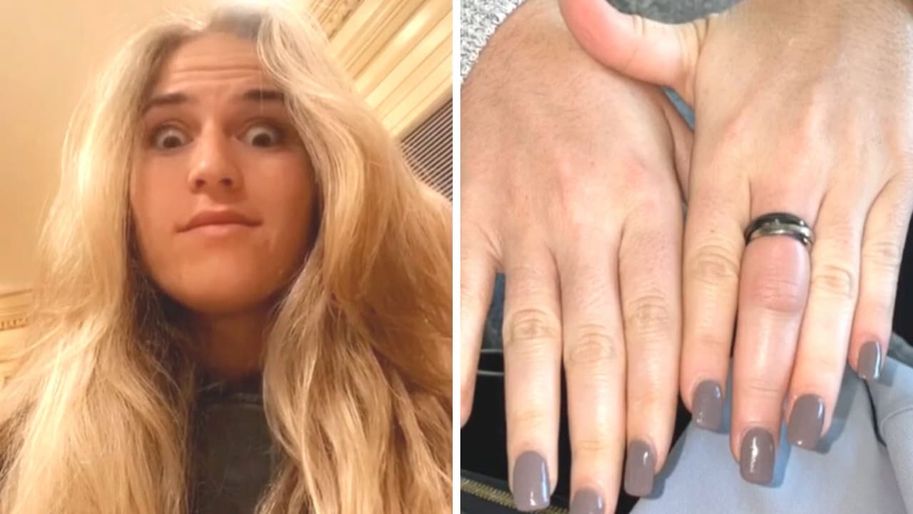 Mujer se duerme con anillo puesto y se vuelve una historia de terror: nadie podía quitárselo