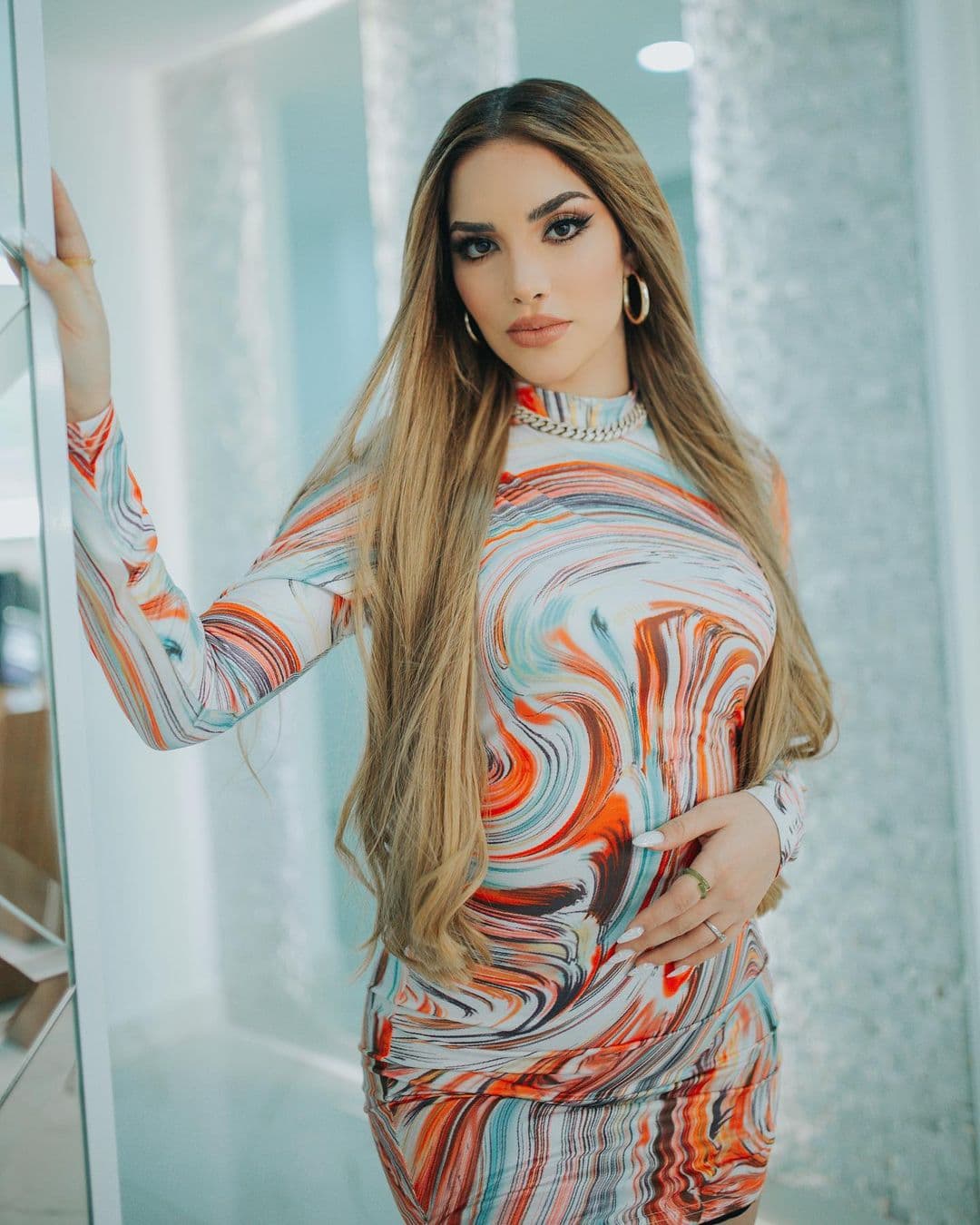 Casi irreconocible, Kimberly Loaiza muestra quemaduras que sufrió durante vacaciones y pide ayuda