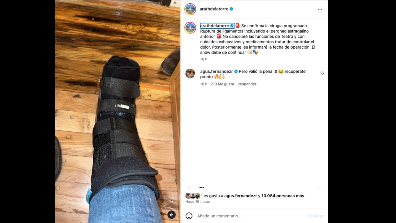 Arath de la Torre confirma que deberá someterse a cirugía tras la lesión que sufrió en 'La casa de los famosos México'