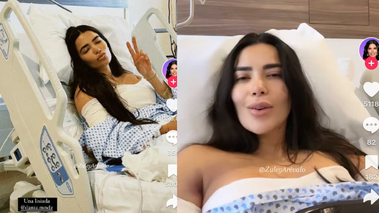 La modelo habló sobre las inseguridades que tenía antes de su cirugía