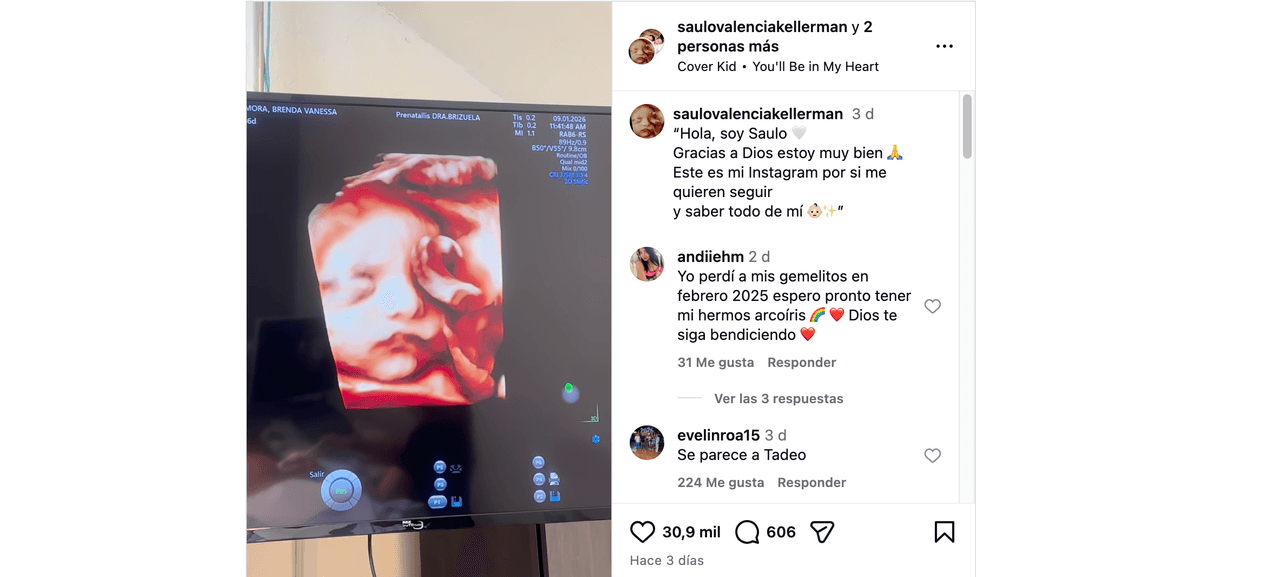 Ferdinando Valencia presume, por fin, la carita de su bebé; hace fuerte revelación sobre el estado de salud del pequeño