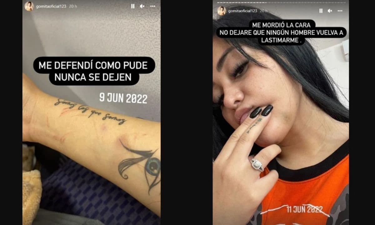 La conductora dejó ver las agresiones que sufrió a manos de su novio