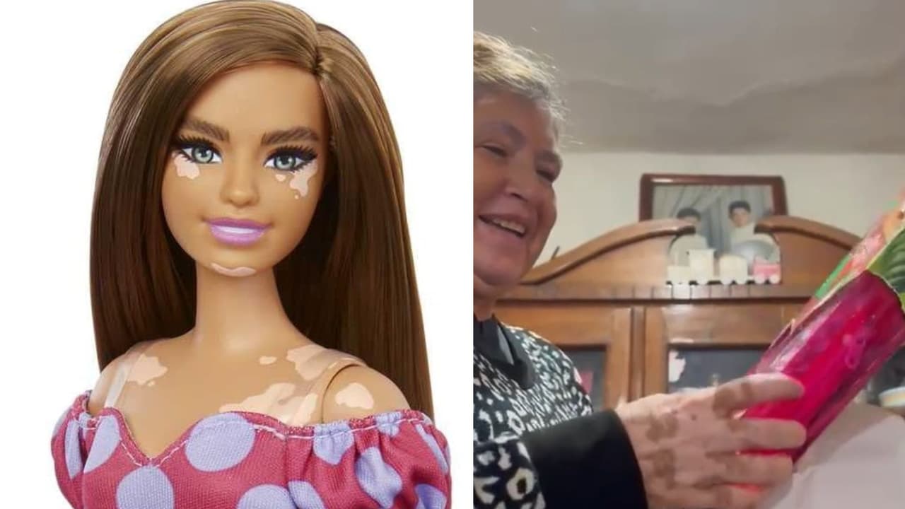 Mujer con vitiligo recibe su primer Barbie y se emociona al ver que se parece a ella