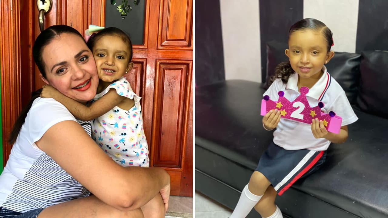 La hija de Martín Rodríguez y Cynthia Osuna padecía el Síndrome de Alagille