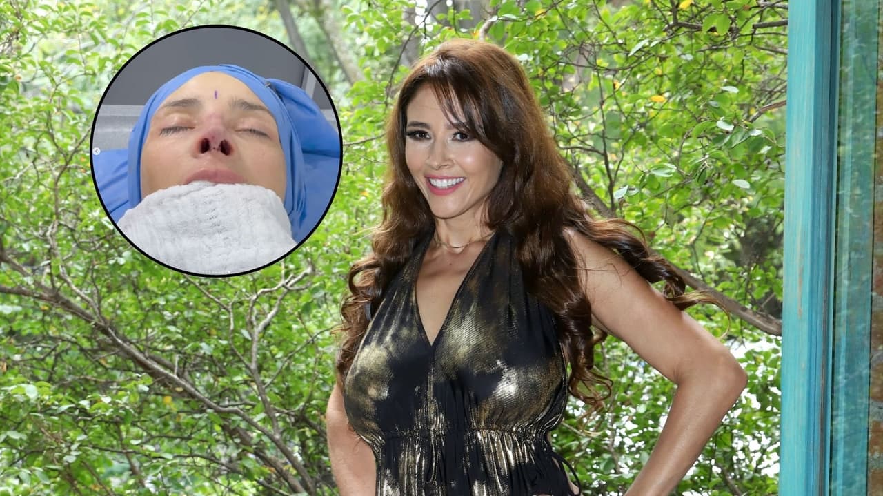 Doctor muestra la reconstrucción de nariz de actriz de ‘Como dice el dicho’; así luce ahora