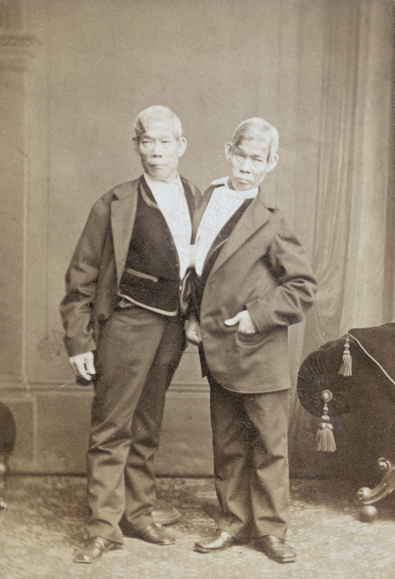 Chang And Eng Bunker murieron con horas de diferencia