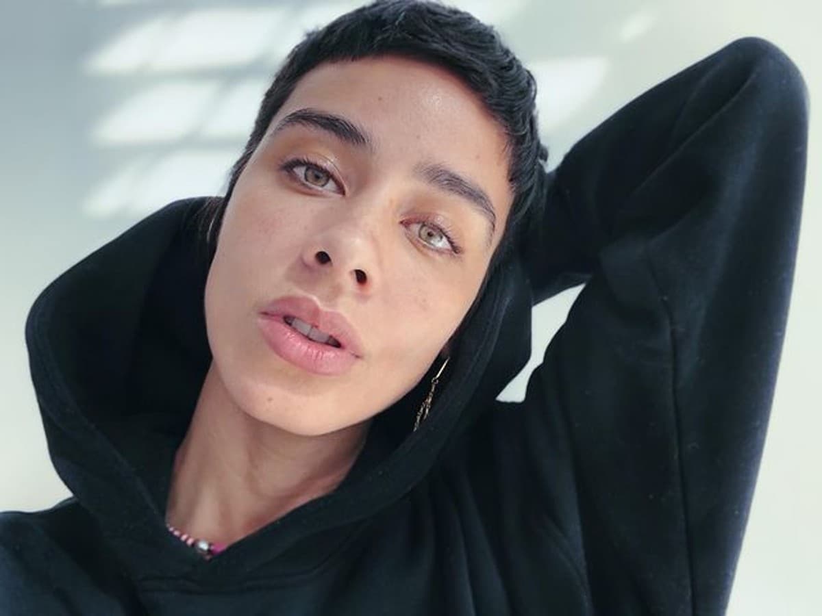 Harta de los retoques estéticos, Esmeralda Pimentel impactó al mostrar con orgullo las estrías de sus glúteos