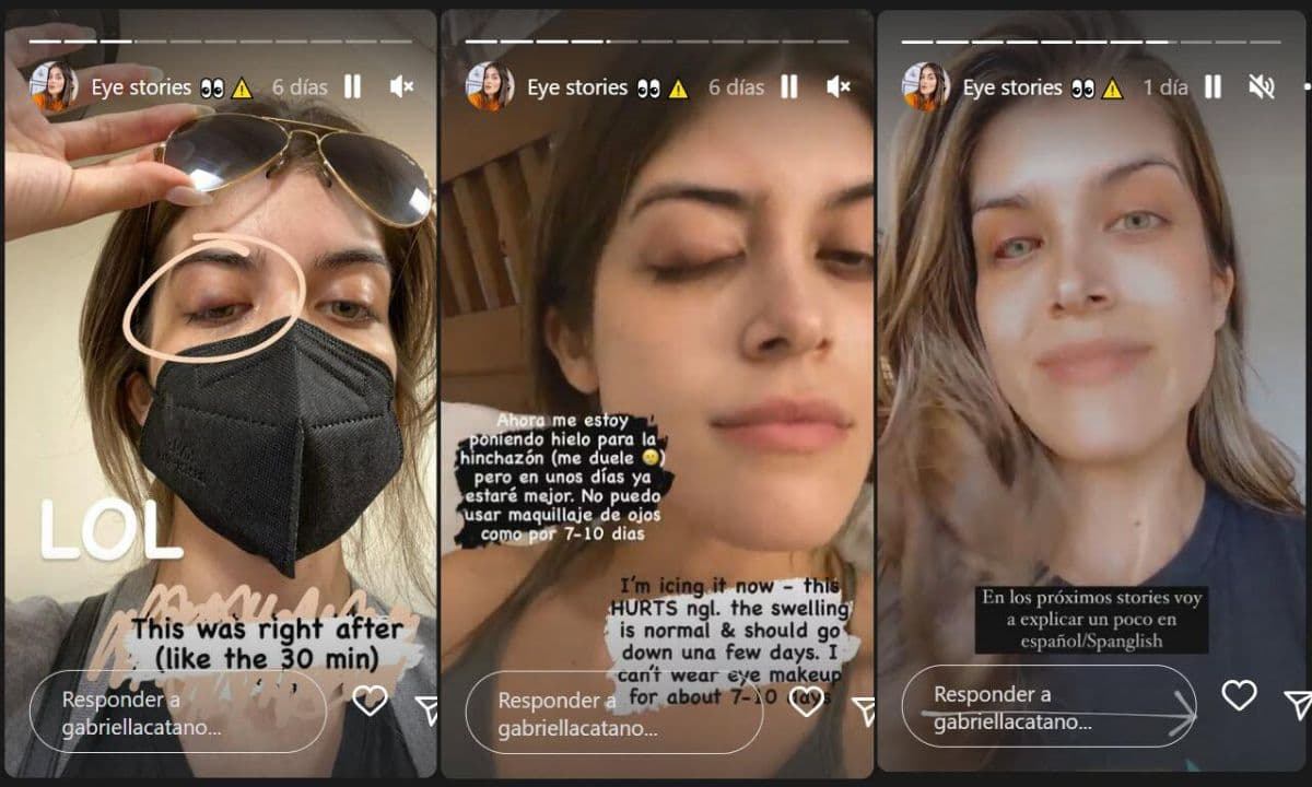 Gabriella publicó varias fotos de su recuperación en redes sociales